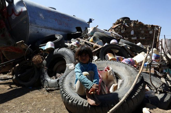 انهيار الخدمات الصحية يهدد 8 ملايين طفل في اليمن
