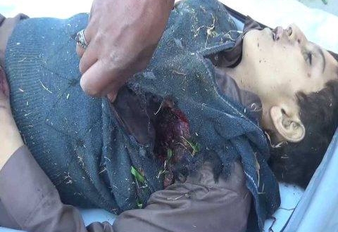 سقوط 3شهداء في باقم والجيش اليمني يرد باستهداف جنود سعوديين في علب