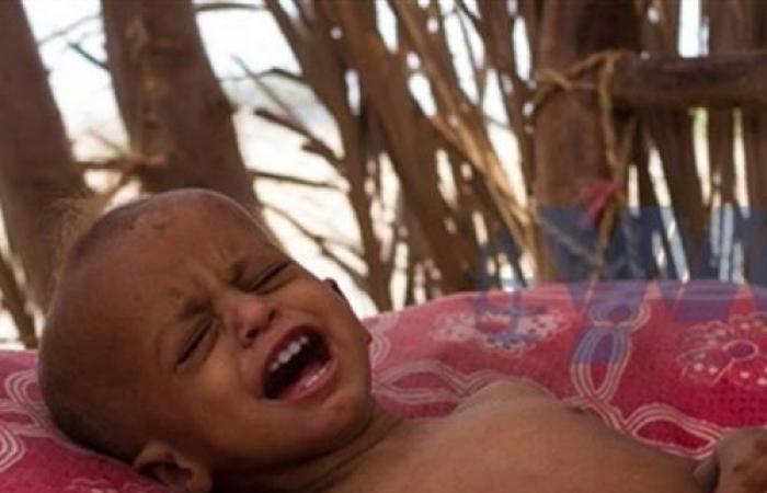 الأمم المتحدة تعلن حالة الطوارئ في اليمن
