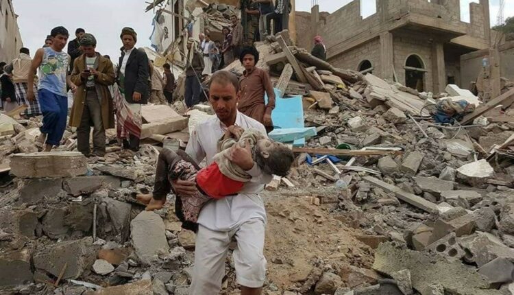 تحقيق صحافي فرنسي يؤكد تورط شركات فرنسية بجرائم حرب في اليمن