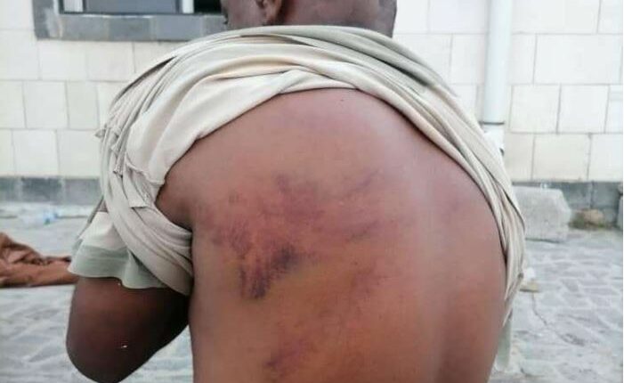 حقوقي يكشف عن انتهاكات خطيرة في سجون عدن والمخا