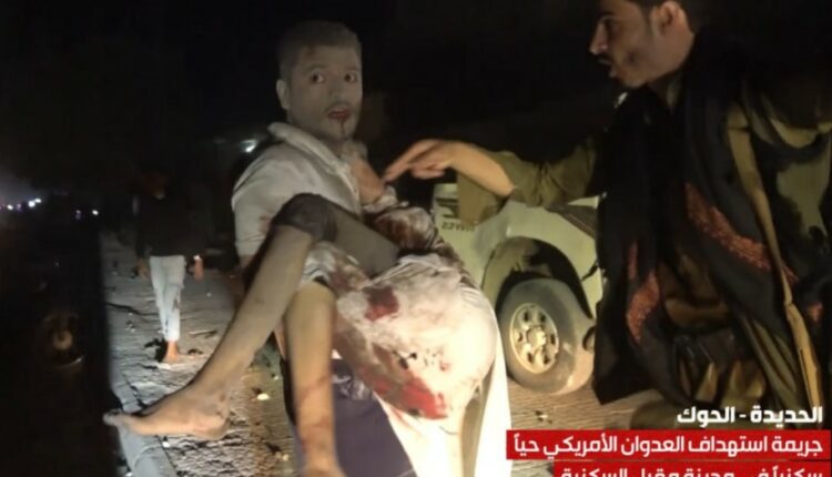 عاجل | ارتفاع عدد الضحايا في الحديدة إلى 6 شهداء و16 جريحا