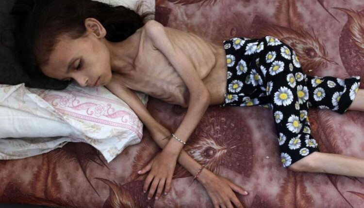 الاحتلال يواصل سياسة التجويع في غزة وسط صمت دولي