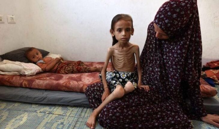 صور مبكية من غزة: مريم… طفلة تذوب جوعا في حضن أمها