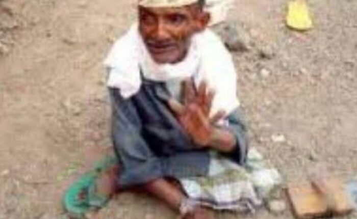 مقتل مواطن معاق دهسًا أثناء اغتيال المحامي النجاشي في تعز