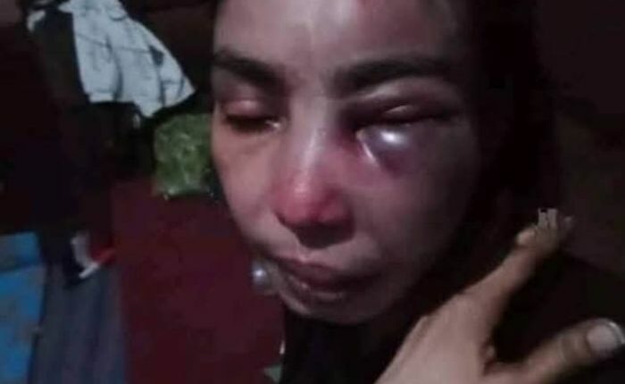 صورة صادمة تفجّر غضبًا شعبيًّا واسعًا… جندي يعتدي بوحشية على امرأة في تعز