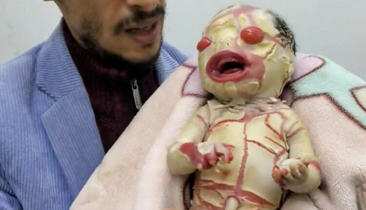 ملف النفايات النووية في اليمن.. جريمة بيئية صامتة تهدد أجيالاً كاملة