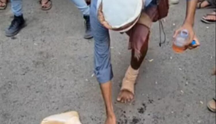 جرحى الإصلاح في تعز يحرقون أطرافهم الصناعية احتجاجاً على قطع رواتبهم وتهميشهم