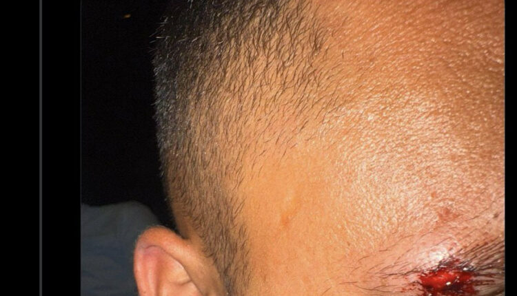 ثلاثة إسرائيليين يتعرضون للضرب المبرح في تايلاند