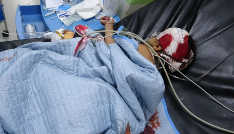 الضالع.. طفلة تصاب برصاص قناصة مقاتلي السعودية في قعطبة