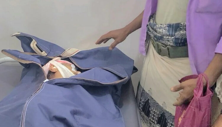 تعز..استشهاد امرأة بقصف على منطقة جسر الصلو
