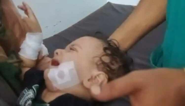 تعز.. قصف مدفعي يؤدي لإصابة أربعة مدنيين بينهم امرأتان وطفلان